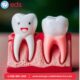 Emergency Dental Service in Carle Place NY for Urgent Treatment!