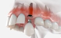 Thumbnail for the listing's main image