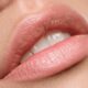 Lip Enhancement Sydney