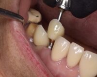 Thumbnail for the listing's main image