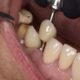 Dental clinic Tijuana
