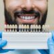 Veneers in Tijuana