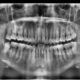 Dental clinic Tijuana