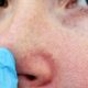 Shrink Pores Permanently? Learn What Really Works