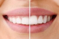 Thumbnail for the listing's main image