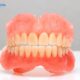 Affordable Dentures for a Healthy, Confident Smile