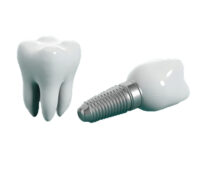 Thumbnail for the listing's main image