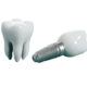 Bristol Prosthodontist | Specialist Tooth Restoration
