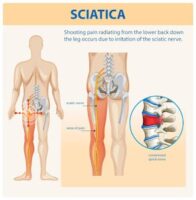 Thumbnail for the listing's main image