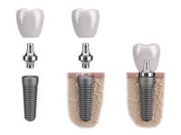 Thumbnail for the listing's main image