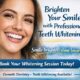 Advanced Teeth Whitening Philadelphia Services