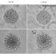 invasion and migration assays