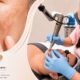 Pico Laser for Melasma & Asian Skin Treatment in Sydney