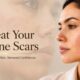 Acne Scar Treatment Sydney: Peels, Laser and Skin Needling