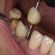 Dental clinic Tijuana