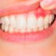 Healthy Gums Support Better Oral Health Every Day