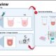 Migration Invasion Assays for Cell Behaviour Studies