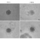 Cell Invasion Assays for Advanced Cancer Research