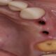 Cosmetic dentist in Tijuana