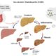 Liver Fibrosis Research Models for NASH Studies