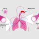 Lung Disease Assay Models for Respiratory Research